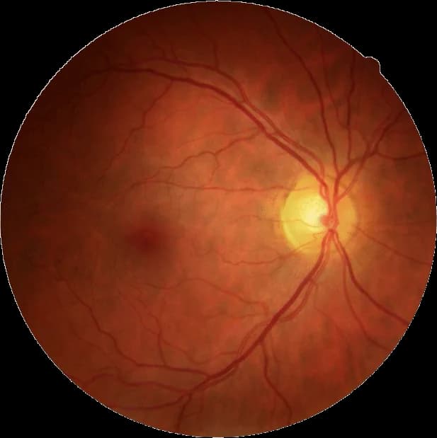 gesundheitscheck.webp